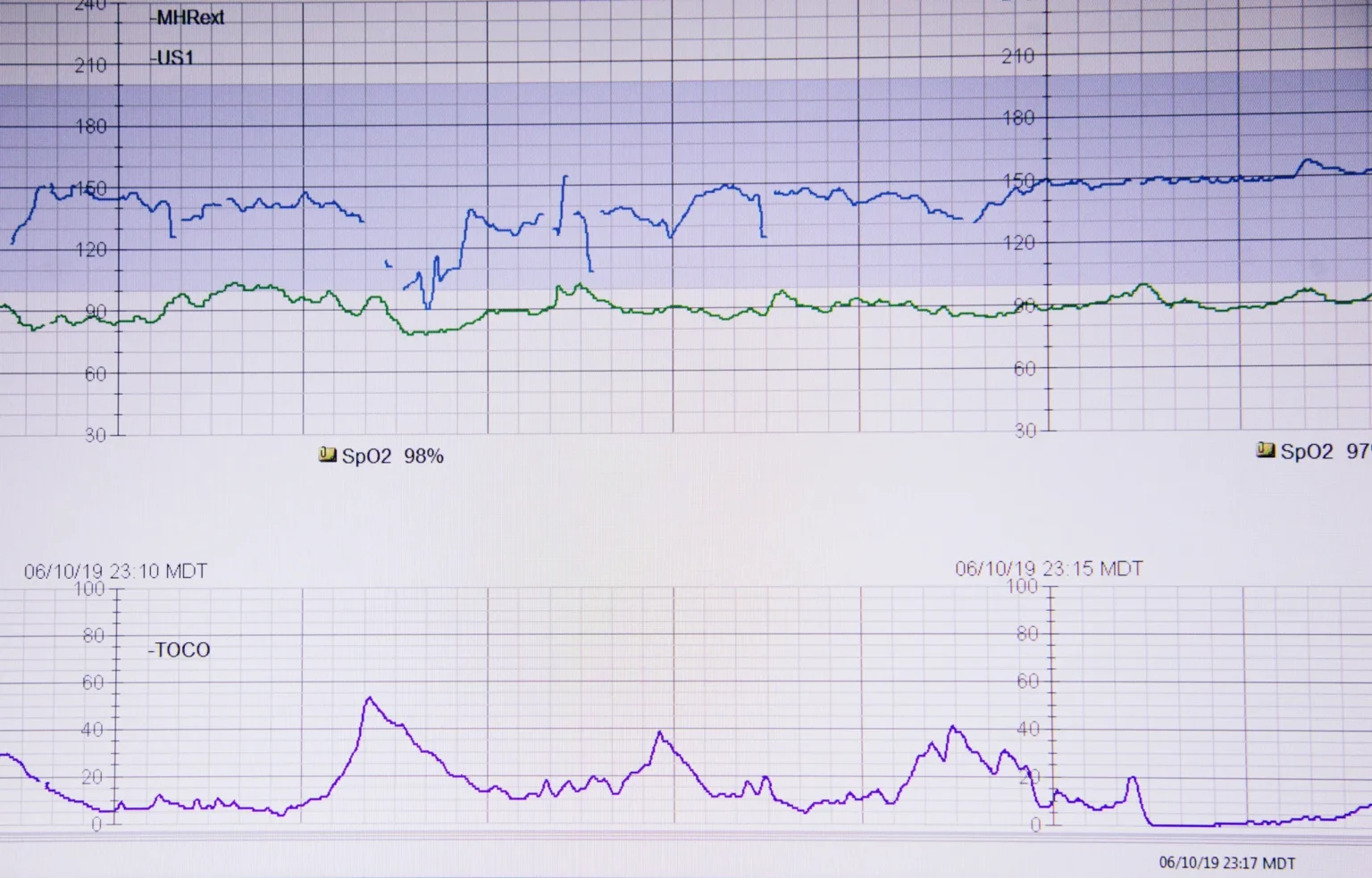 $matic tests critical support level as bearish signals emerge - Bpay News