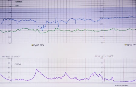 $MATIC Tests Critical Support Level as Bearish Signals Emerge